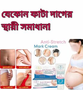শুধু এন্ট্রি স্টিচ মার্ক